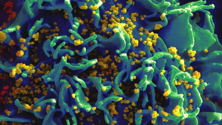 España lanza un programa nacional de autotest de VIH a domicilio para combatir diagnósticos tardíos